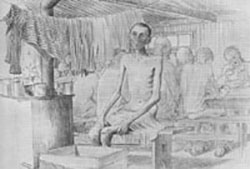Dysenteri